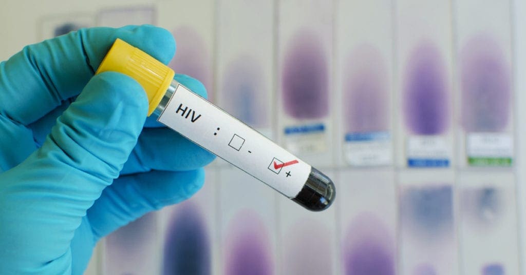 hiv 1