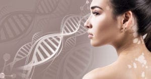 Aché planeja medicamento para vitiligo em 2023