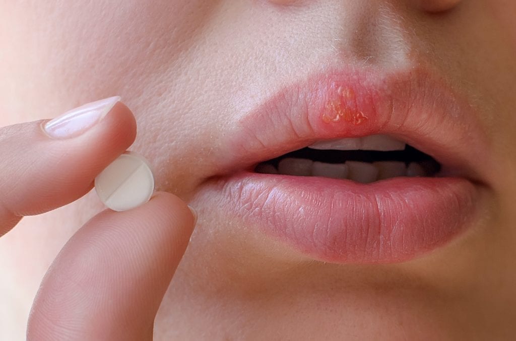 Efeitos colaterais Aciclovir