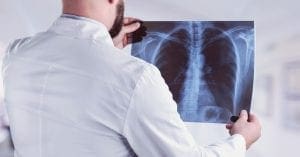 Anvisa aprova Evobrig (brigatinibe) para pacientes com câncer de pulmão metastático