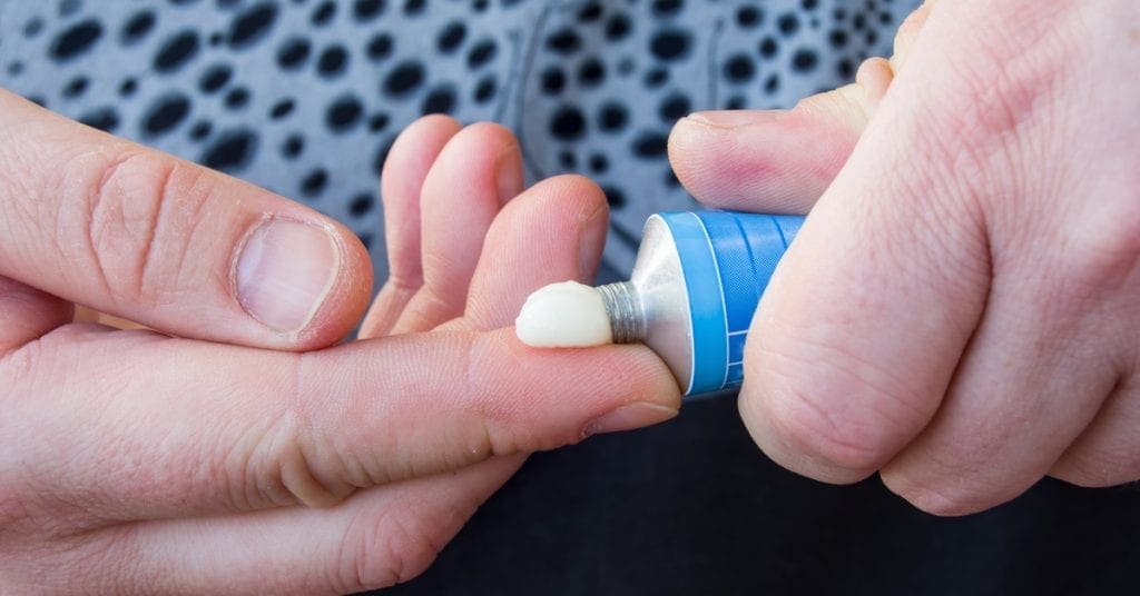 cortisona em pomadas