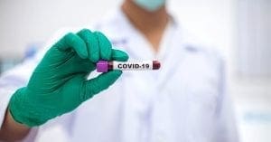 Febrafar alerta sobre riscos de testes rápidos de Covid-19 em farmácias