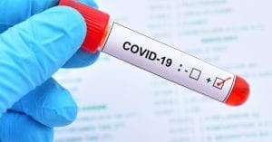 Teste de Covid-19 nas farmácias: implantar ou não?