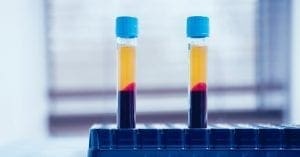 Plasma contra Covid-19 é testado em 26 estudos no Brasil