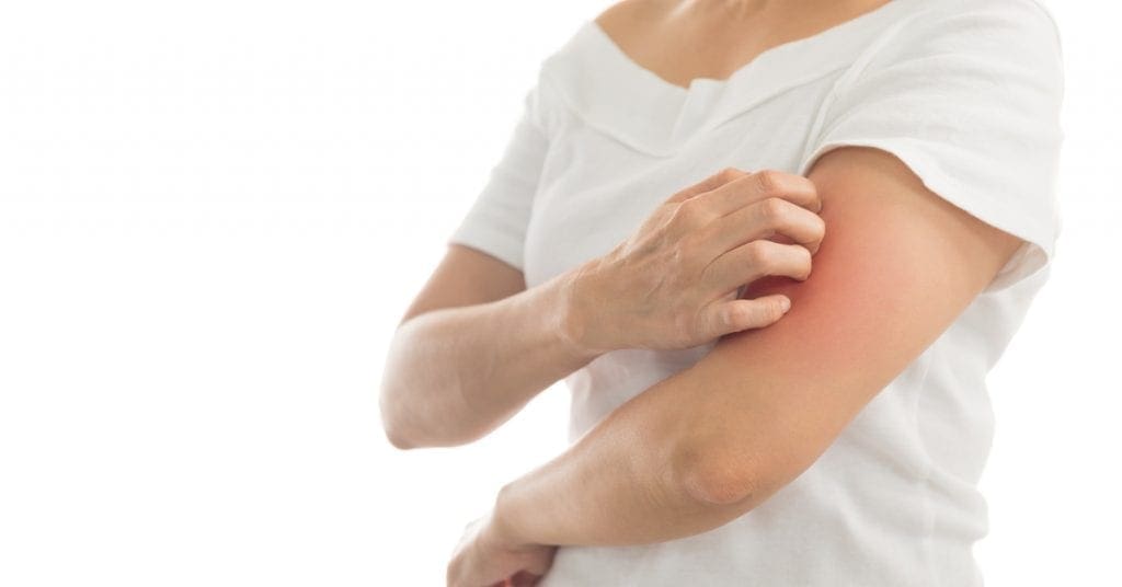 o-uso-da-cannabis-no-tratamento-da-psoriase