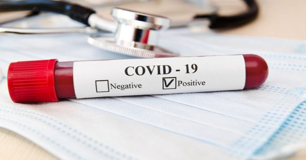 testes-positivos-covid-farmácias