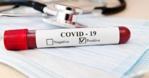 Farmácias têm recorde de 12.790 testes rápidos positivos em uma semana