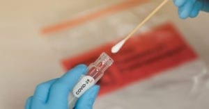 10 dicas para garantir a confiabilidade nas testagens contra a Covid-19