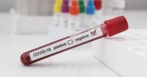 Governo exigirá exame negativo de Covid-19 para brasileiro ou estrangeiro entrar no país