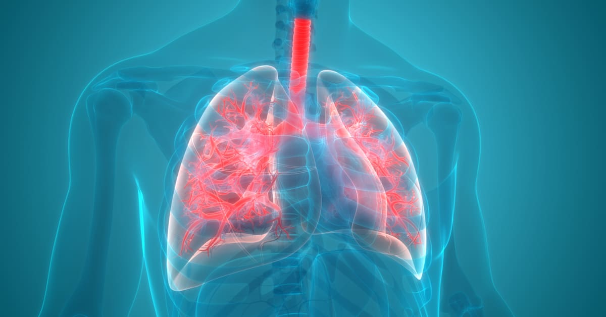 pneumonia sintomas