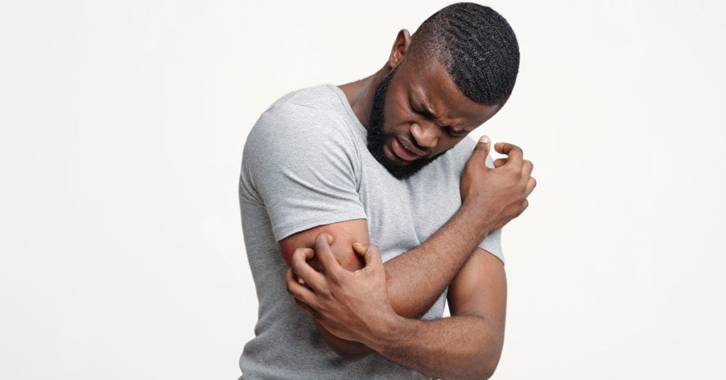Psoríase-o-que-é-tratamentos-tem-cura-É-contagioso