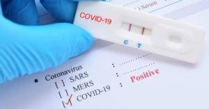 Brasil chega a 10 milhões de diagnósticos positivos de Covid-19