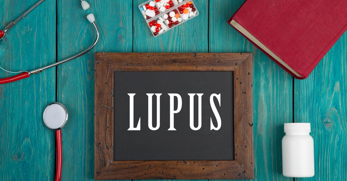 Lúpus-tratamento