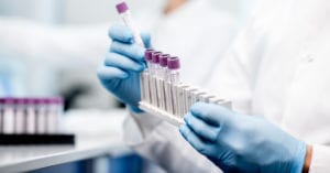 Quatro boas notícias sobre novos tratamentos em testes contra a Covid-19