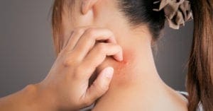 Dermatologista alerta para doenças de pele que mais aparecem no outono