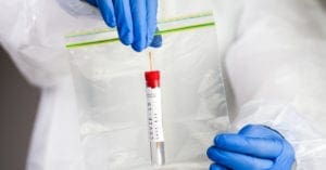 Reinfecção por Covid-19 pode ser mais agressiva e não depende de variantes