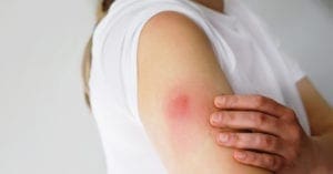 Saiba quais são os efeitos colaterais das vacinas de Covid-19 em uso no Brasil