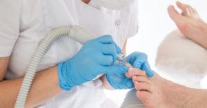 Mitos e verdades sobre a micose de unha