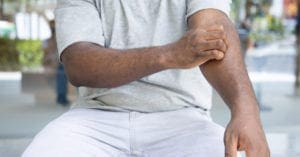 Como tratar a micose?