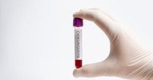 Chikungunya tem letalidade maior que dengue no Brasil