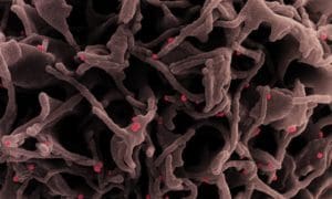 Nascida nos EUA, variante Lota chama a atenção pela letalidade