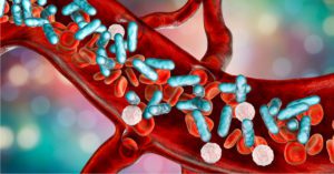 BD promove webinar sobre sepse para capacitar sobre complicação responsável por 20% das mortes globais