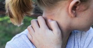 Sanofi Genzyme lança campanha para falar sobre impacto da dermatite atópica em crianças