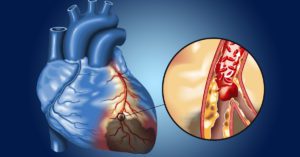 Einstein e Novartis iniciam estudo sobre qualidade assistencial das doenças cardiovasculares no Brasil
