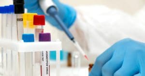 Ministério da Saúde anuncia COE para vacinação contra a varíola dos macacos no Brasil