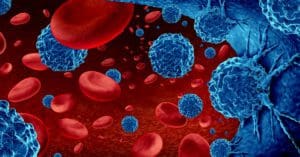 Pesquisa revela que o mieloma múltiplo afeta as atividades diárias de 62% dos pacientes