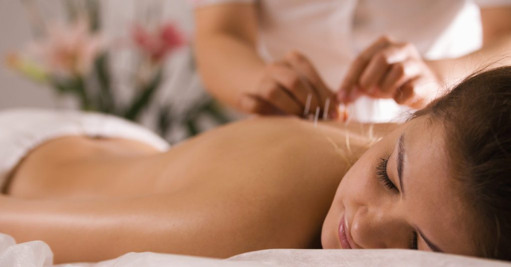 acupuntura-farmacêuticos