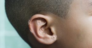 Atuação do farmacêutico em auriculoterapia/auriculoacupuntura é regulamentada pelo CFF