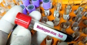 Anvisa recebe novos pedidos de registro de produtos para diagnóstico da monkeypox