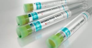 Anvisa aprova mais um teste para diagnóstico da monkeypox no Brasil