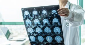 A importância de uma rotina de monitoramento para diagnóstico e tratamento do AVC