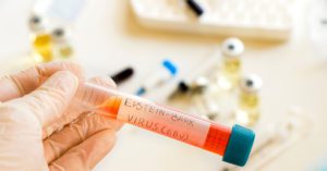 Vírus de Epstein-Barr: o que, como é transmitido e sintomas