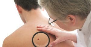 Mitos e verdades sobre o câncer de pele