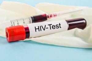 Tuberculose e Aids podem ser eliminadas no Brasil, diz novo diretor do Ministério da Saúde