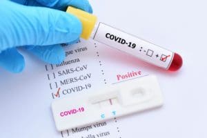 Testes positivos de covid podem escalonar em farmácias