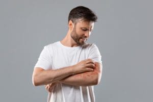 Exclusivo: Como cuidar da dermatite atópica no dia a dia