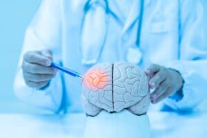 EMS apoia campanha de prevenção do AVC