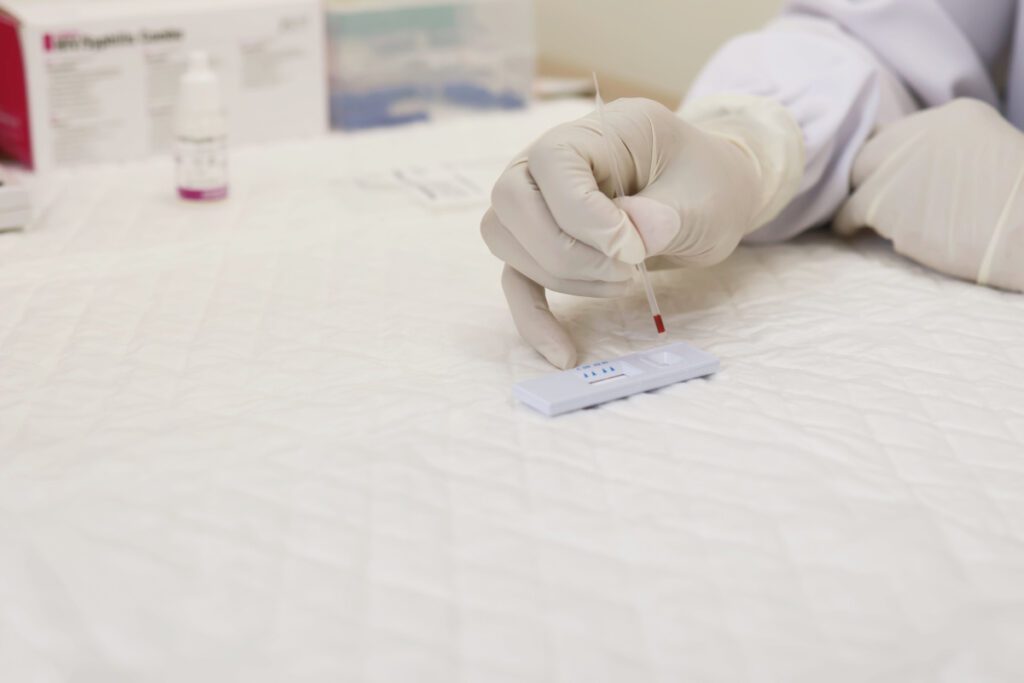 casos-de-sifilis-e-de-hiv-aids-aumentam-entre-homens-jovens