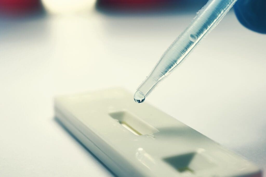 procura-por-testes-rapidos-da-dengue-nas-farmacias-aumentou-650-entre-novembro-e-janeiro