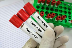 Dengue: atendimentos em hospitais da Rede D’Or pelo país crescem 38% em uma semana