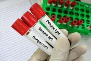 Dengue: Brasil lidera ranking global da doença, segundo OMS