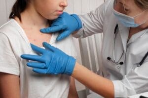 Hcor registra crescimento de 3.500% em casos de dengue