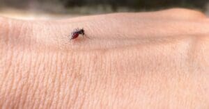 Ministério da Saúde faz alerta sobre febre oropouche