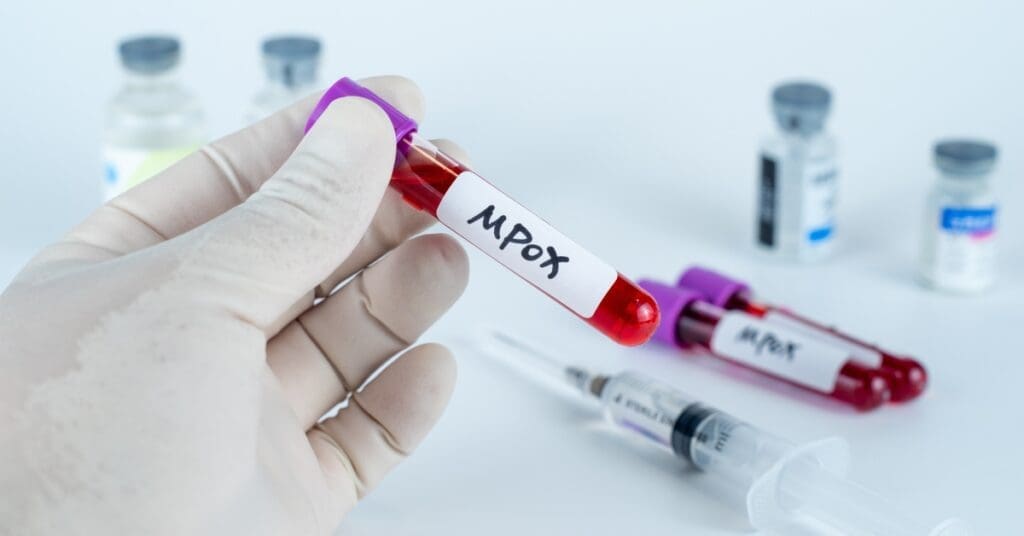 OMS-declara-mpox-como-emergência-em-saúde-pública-global