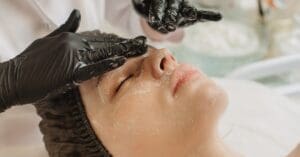 Peeling: o que é e seus benefícios para a pele