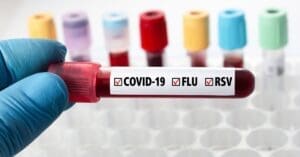 Covid: saiba sintomas da XEC, nova variante registrada no Brasil